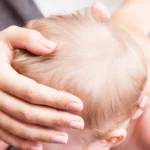 Tortícolis congénita en bebés: qué es y qué síntomas tiene