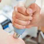 Ondas de choque en fisioterapia: qué son, para qué sirven y beneficios